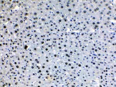 2 - Anti-HDGF Picoband Antibody ABO10143