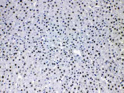 2 - Anti-HDGF Picoband Antibody ABO10143