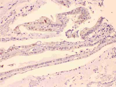 2 - Anti-HDGF Picoband Antibody ABO10143