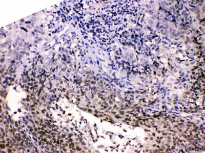 2 - Anti-HDGF Picoband Antibody ABO10143