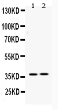 1 - Anti-HDGF Picoband Antibody ABO10143