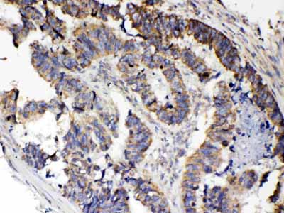 2 - Anti-RANK Picoband Antibody ABO10145