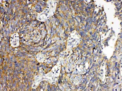 2 - Anti-RANK Picoband Antibody ABO10145