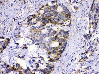 2 - Anti-MUT Picoband Antibody ABO10146