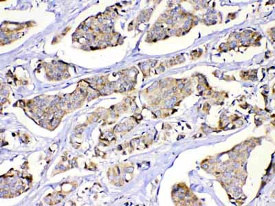 2 - Anti-MUT Picoband Antibody ABO10146