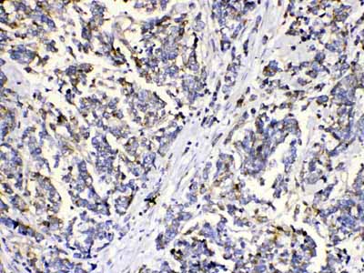 2 - Anti-MUT Picoband Antibody ABO10146