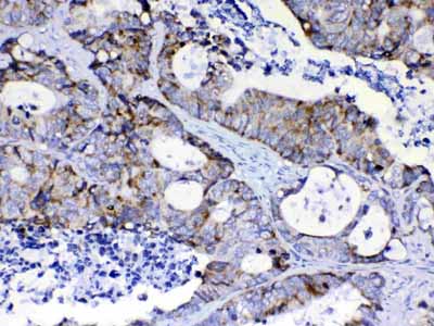 2 - Anti-PIK3CB Picoband Antibody ABO10151