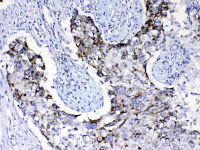 2 - Anti-PIK3CB Picoband Antibody ABO10151