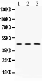 1 - Anti-Galactosidase alpha Picoband Antibody ABO10155