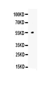 1 - Anti-ANGPTL4 Picoband Antibody ABO10157