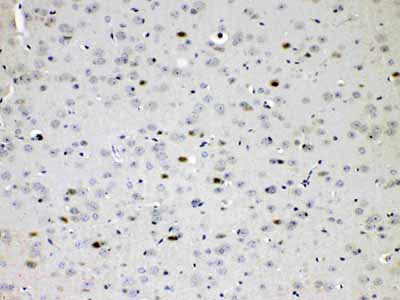 2 - Anti-CHAT Picoband Antibody ABO10161