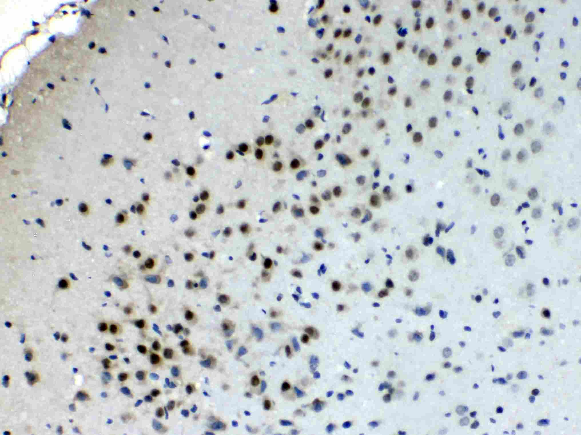 2 - Anti-CHAT Picoband Antibody ABO10161