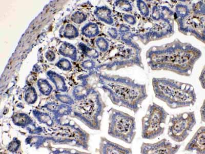2 - Anti-Cytoglobin Picoband Antibody ABO10162