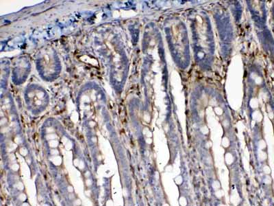 2 - Anti-Cytoglobin Picoband Antibody ABO10162