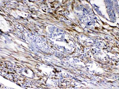 2 - Anti-Cytoglobin Picoband Antibody ABO10162