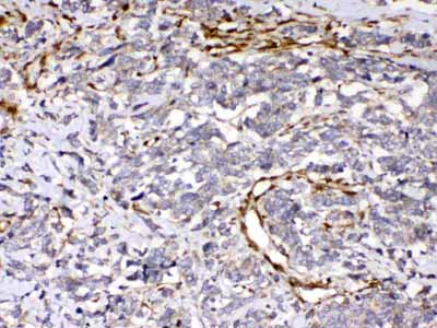 2 - Anti-Cytoglobin Picoband Antibody ABO10162