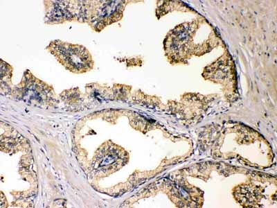 2 - Anti-DBI Picoband Antibody ABO10170