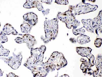 2 - Anti-DBI Picoband Antibody ABO10170