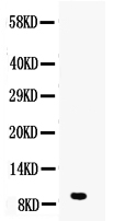 1 - Anti-DBI Picoband Antibody ABO10170