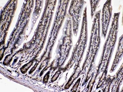 2 - Anti-Cyclophilin A Picoband Antibody ABO10176