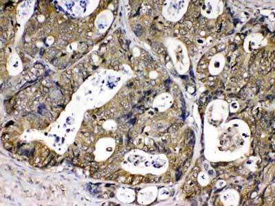 2 - Anti-Cyclophilin A Picoband Antibody ABO10176
