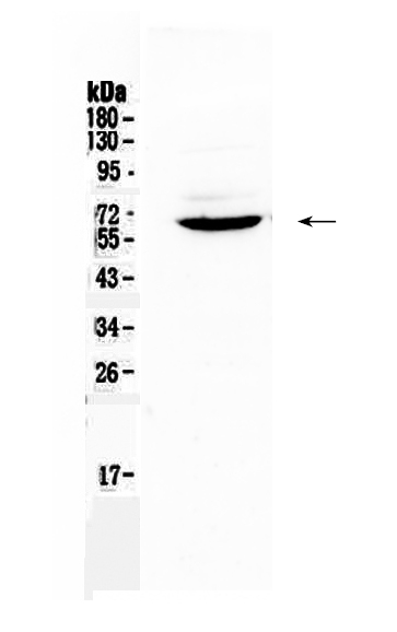 1 - Anti-Heparanase 1 Picoband Antibody ABO10177