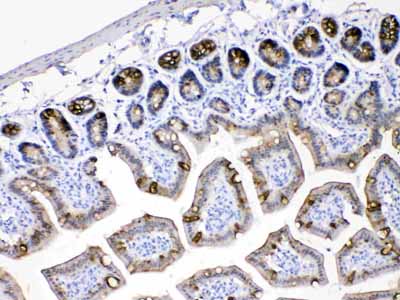 2 - Anti-Cytokeratin 18 Picoband Antibody ABO10178