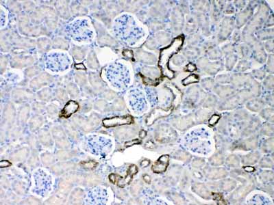 2 - Anti-Cytokeratin 18 Picoband Antibody ABO10178