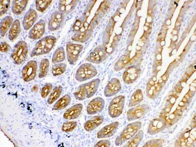 2 - Anti-Cytokeratin 18 Picoband Antibody ABO10178