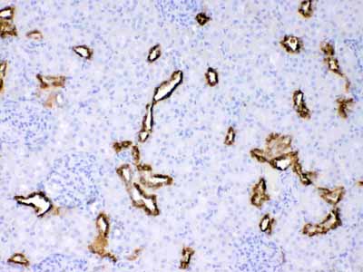 2 - Anti-Cytokeratin 18 Picoband Antibody ABO10178