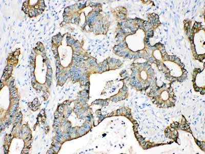 2 - Anti-Cytokeratin 18 Picoband Antibody ABO10178