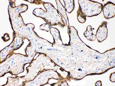2 - Anti-Cytokeratin 18 Picoband Antibody ABO10178