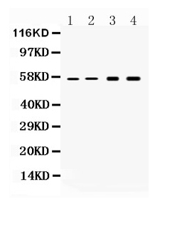 1 - Anti-Cytokeratin 18 Picoband Antibody ABO10178