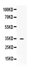 1 - Anti-NAT1 Picoband Antibody ABO10180