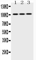1 - Anti-Hexokinase II Picoband Antibody ABO10181