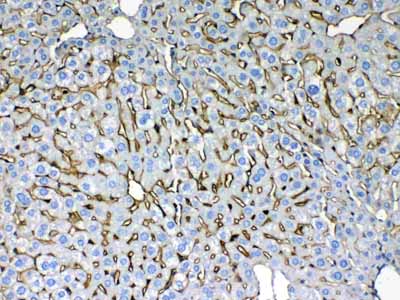 2 - Anti-Cytokeratin 8 Picoband Antibody ABO10184