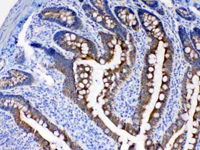 2 - Anti-Cytokeratin 8 Picoband Antibody ABO10184