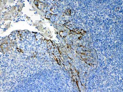 2 - Anti-Cytokeratin 8 Picoband Antibody ABO10184