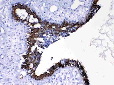 2 - Anti-Cytokeratin 8 Picoband Antibody ABO10184