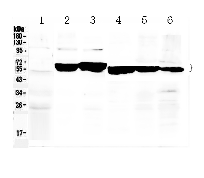 1 - Anti-Cytokeratin 8 Picoband Antibody ABO10184