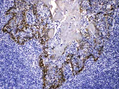 2 - Anti-Cytokeratin 14 Picoband Antibody ABO10185