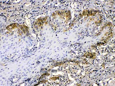 2 - Anti-Cytokeratin 14 Picoband Antibody ABO10185