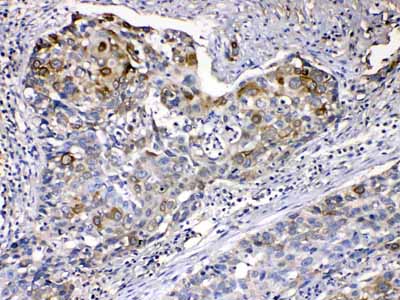 2 - Anti-Cytokeratin 14 Picoband Antibody ABO10185