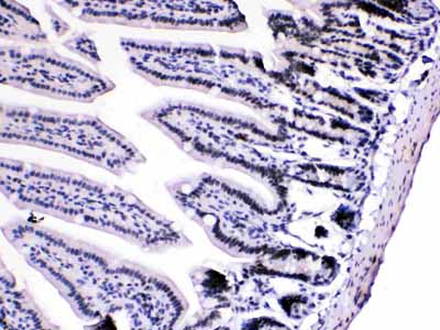 2 - Anti-HnRNP A1 Picoband Antibody ABO10189