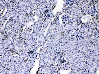 2 - Anti-HnRNP A1 Picoband Antibody ABO10189