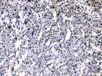 2 - Anti-HnRNP A1 Picoband Antibody ABO10189