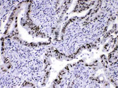 2 - Anti-HnRNP A1 Picoband Antibody ABO10189