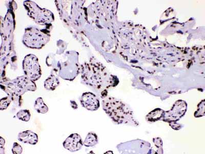 2 - Anti-HnRNP A1 Picoband Antibody ABO10189