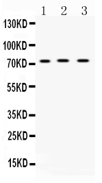1 - Anti-ABCG8 Picoband Antibody ABO10190