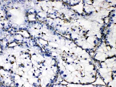 2 - Anti-GAA Picoband Antibody ABO10192